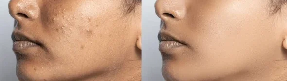 concept-skin-care-before-after-600nw-2190112781