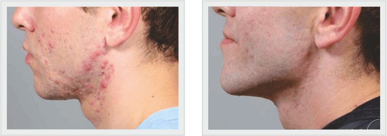 BEFORE N AFTER-1 (1)