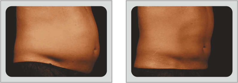 BEFORE N AFTER-1 (2)