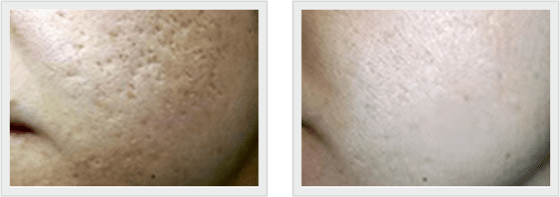 BEFORE N AFTER-2 (2)