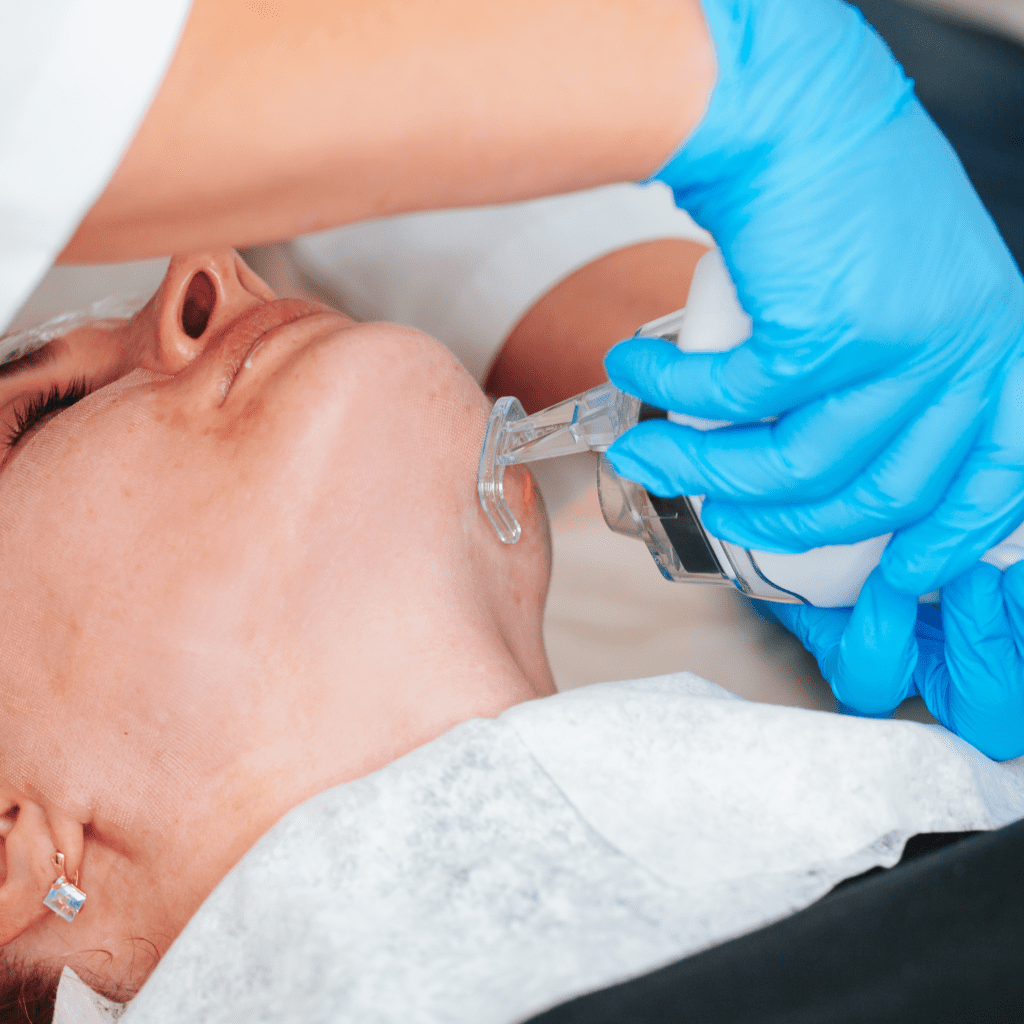 Skin Rejuvenation & Resurfacing