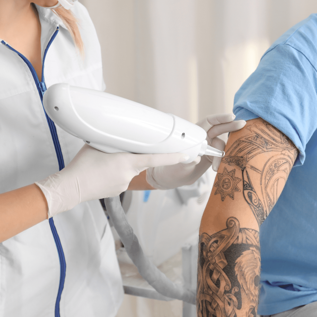 Removal of Tattoos and Pigmentation​